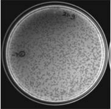 Enriched bacteriophage plaques at 10- 7 dilution