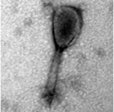 TEM photo of bacteriophage